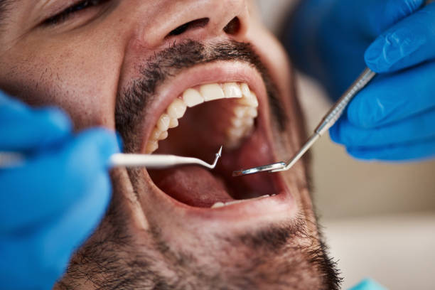 Best Same-Day Emergency Dental Services in Campti, LA