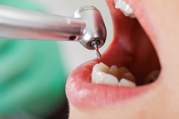 Best Emergency Treatment for Dental Infections or Abscesses in Campti, LA
